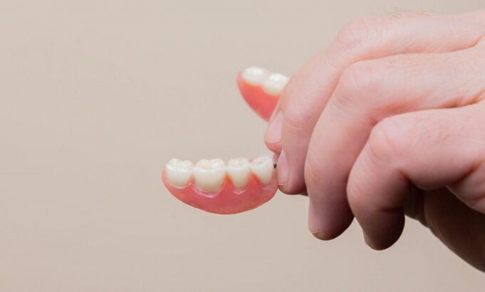 Dental Veneer